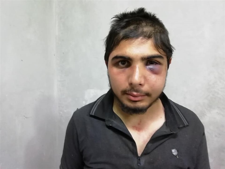 Syrian journalist, family assaulted by Turkish border guards