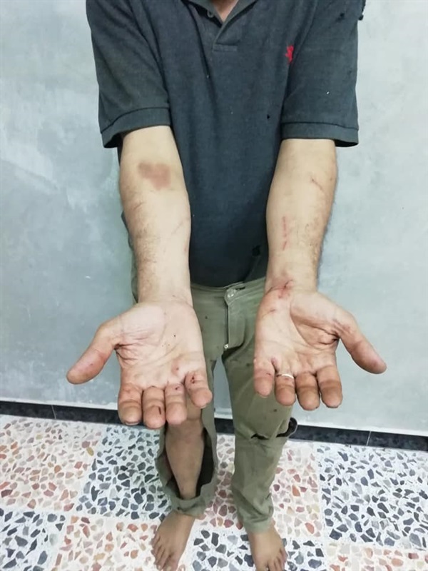 Syrian journalist, family assaulted by Turkish border guards